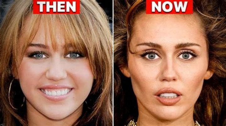 Before & After — Did She Get Plastic Surgery On Her Face? – Hollywood Life