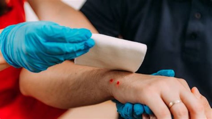 Record-Breaking Number of Snake Bites Prompts New Guidance on Staying Safe